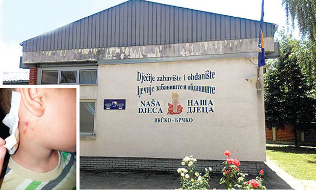 Васпитачица у вртићу тукла попово дете?